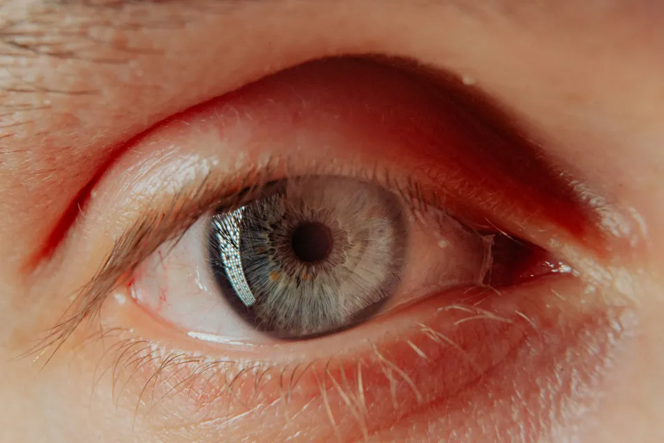 Œil photographique traité en hologramme olive